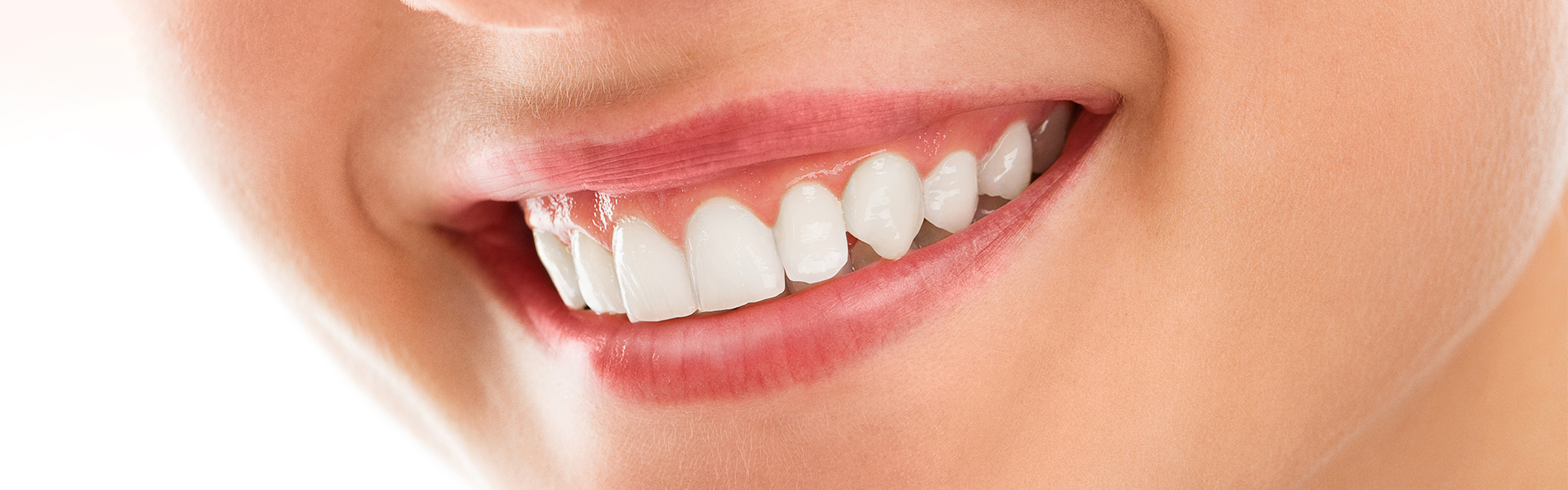 Brighten Your Smile: Discover How Long Teeth Whitening Lasts